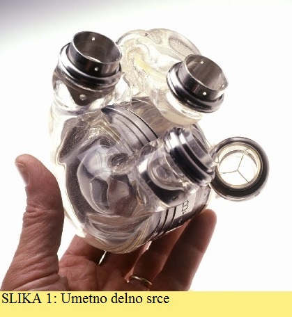 SLIKA 1: Umetno delno srce